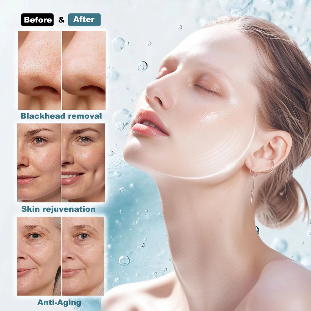 7-in-1 Hydro Aqua Dermabrasion Machine With LED Mask for Beauty Salon and Home